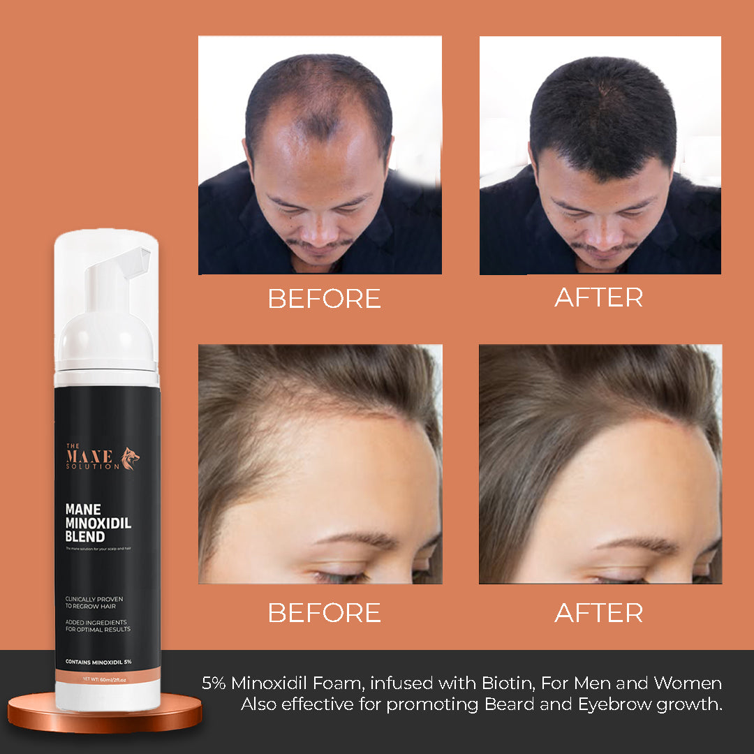 Mane Minoxidil Blend